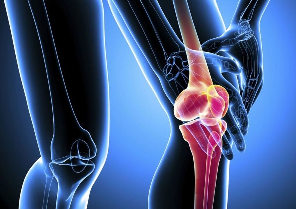 Болка по време на физическа активност при остеоартрит на колянната става